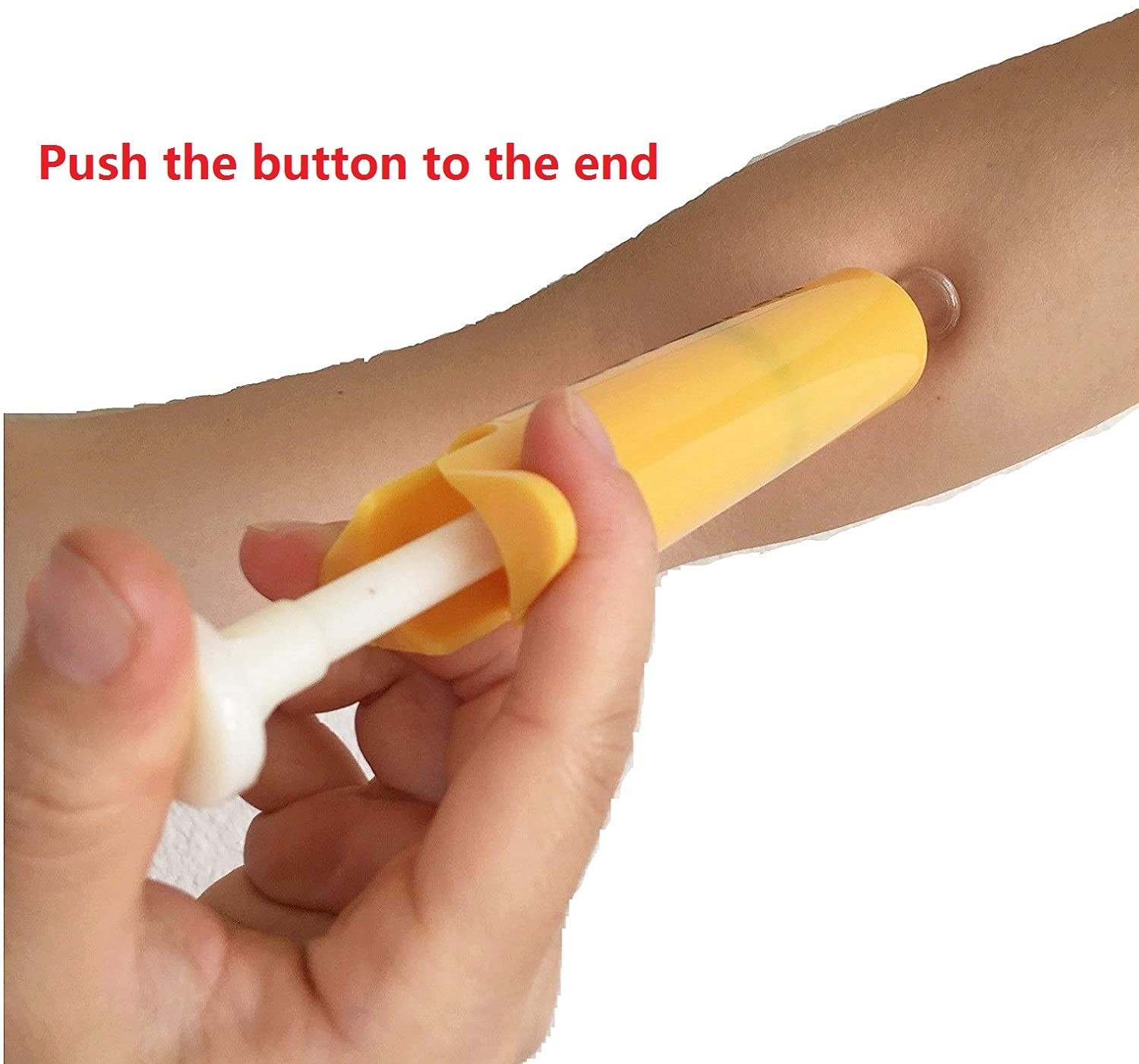 Insect Bite Venom Extractor Suction Kit – First Aid Tool for Hiking & Camping