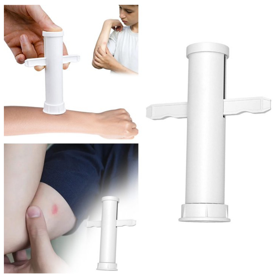 2 PK Bug Bite Relief Insect Poison Remover Suction Tool For Insect Bite Sting