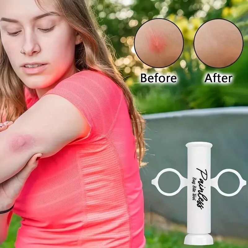 Bug Bite Painless Suction Tool Poison Remover Insect Bite and Sting – 1 Pack!