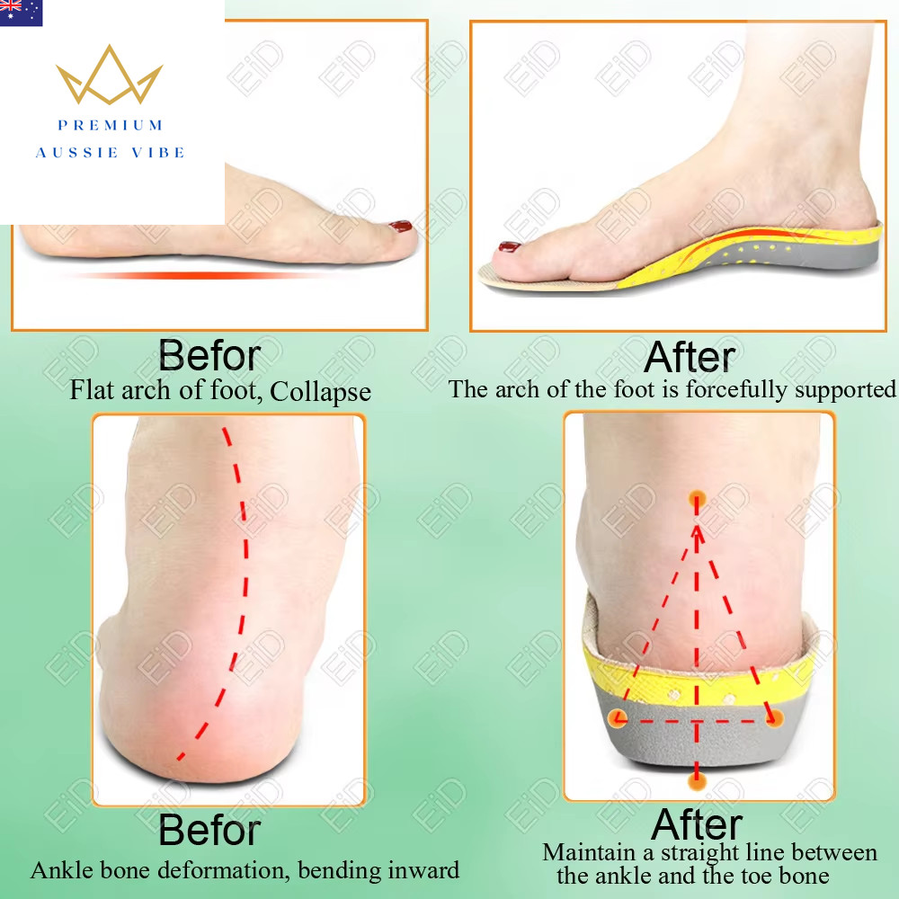 Premium Orthotic Gel Insoles Orthopedic Flat Foot Health Sole Pad for Shoes Inse