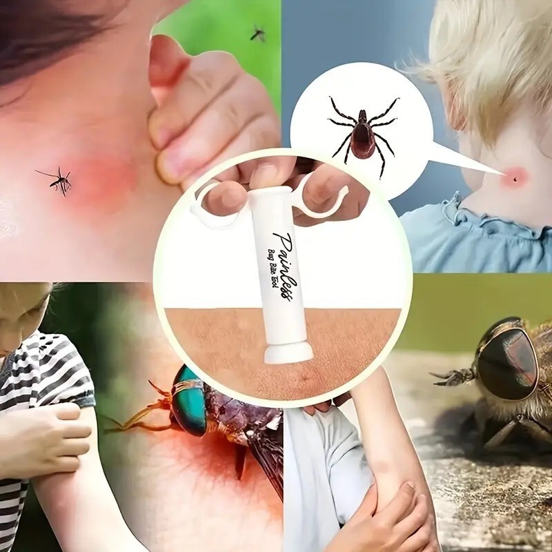 Bug Bite Painless Suction Tool Poison Remover Insect Bite and Sting – 1 Pack!