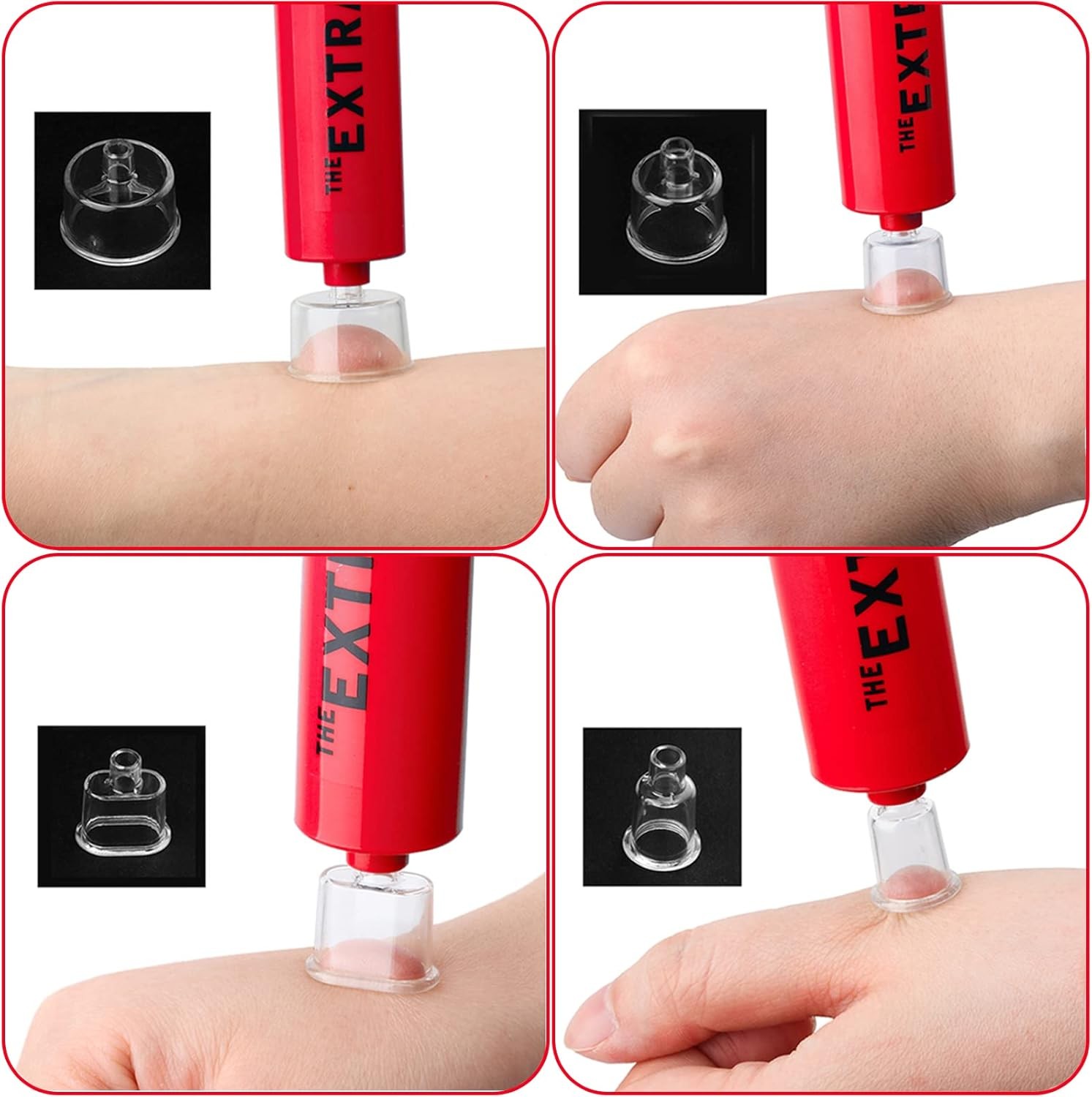 Snake Bite Kit, Bee Sting Kit, Emergency First Aid Supplies, Venom Extractor Suc