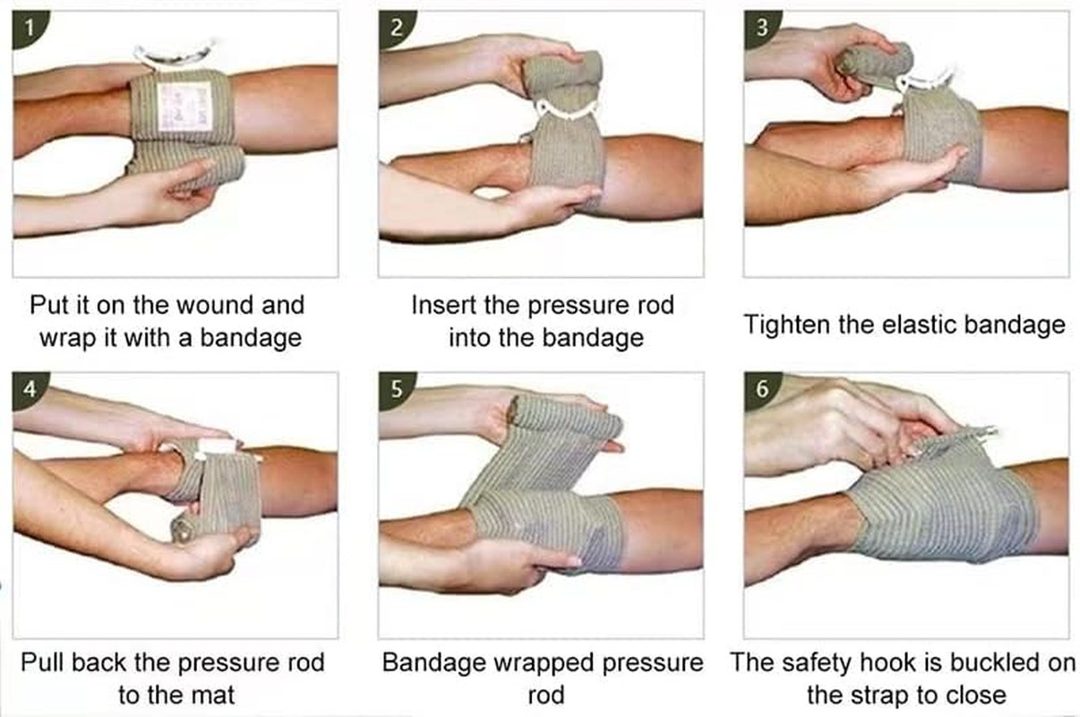 Portable 6 Inch Israeli Bandages – 10 Pack Trauma Wound Seal for Outdoor Use