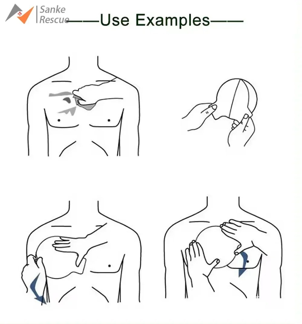 Vent Chest Seal Life-Saving Wound Care for Emergency or Tactical Situations Adva