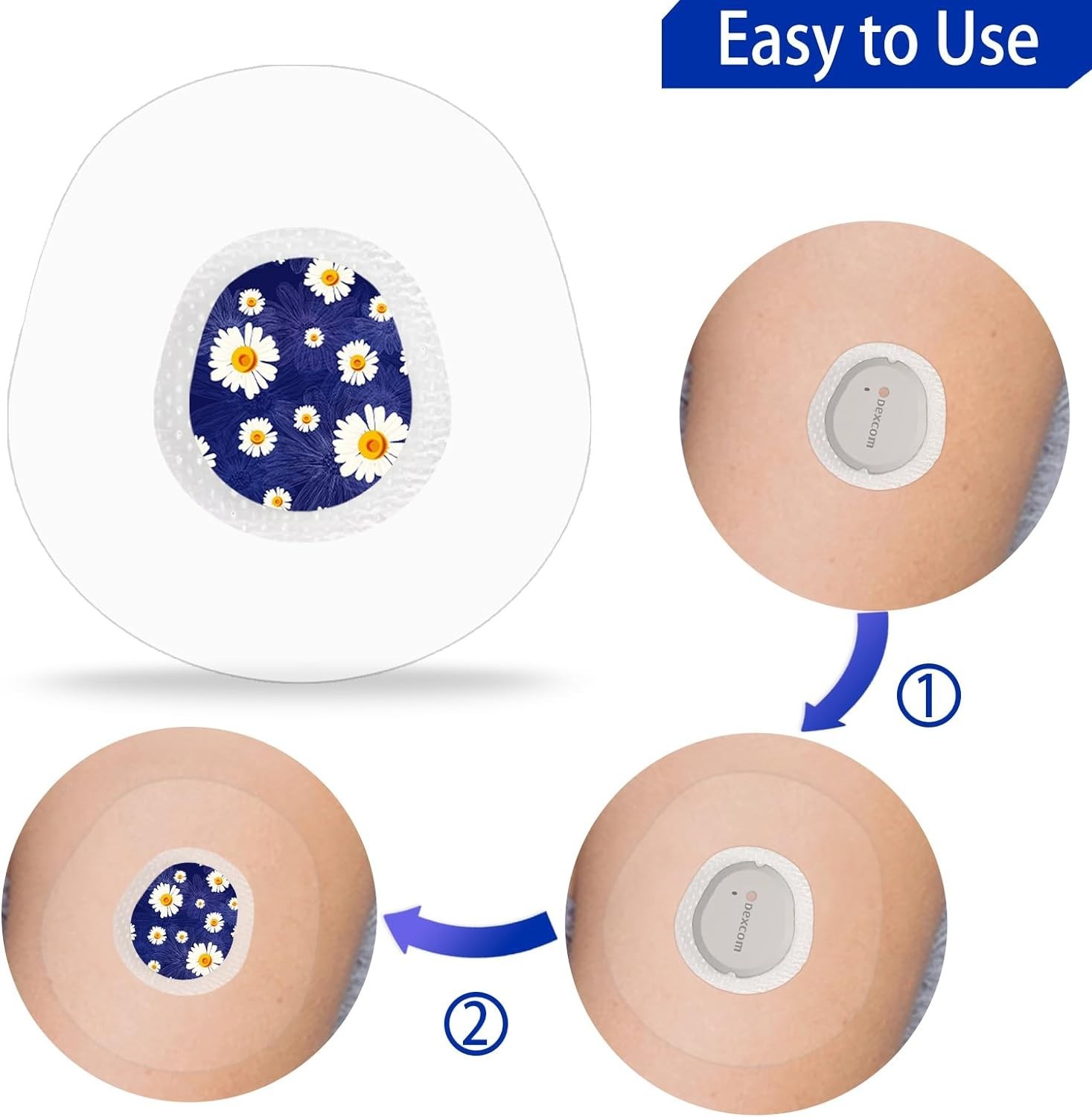 40 Pack G7 Over Patches & Floral Sensor Stickers – Waterproof & Hypoallergenic