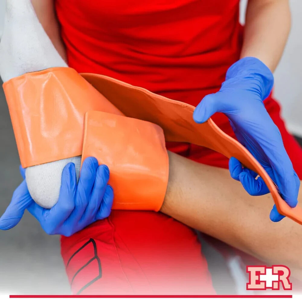 Ever Ready First Aid Universal Aluminum Splint Orange – 36″ Rolled