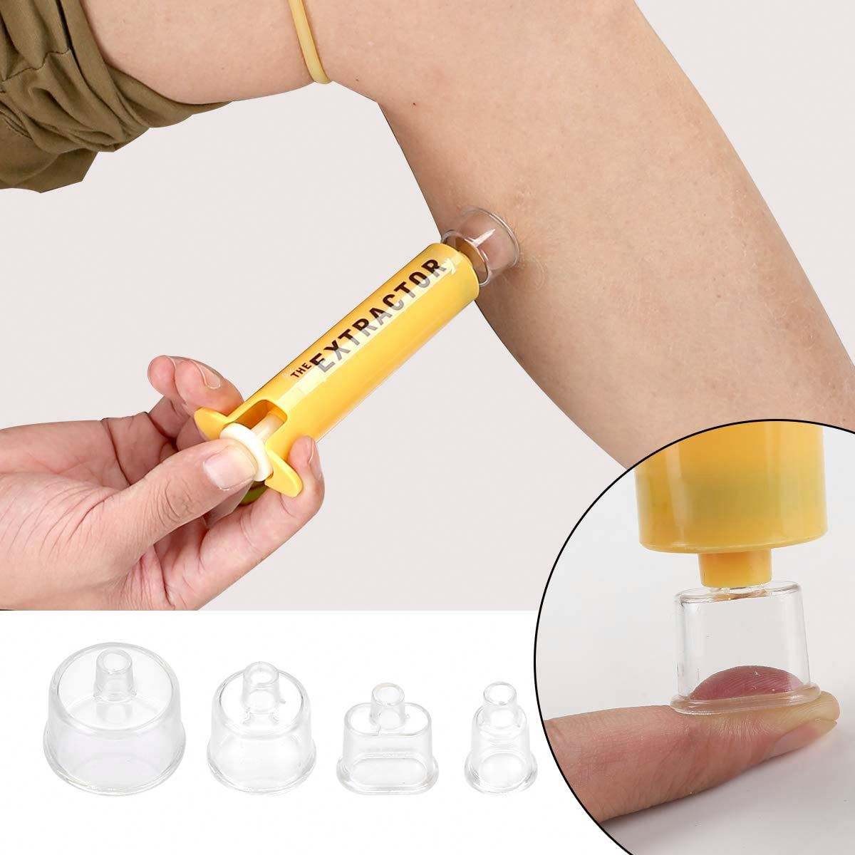 Portable Venom Poison Extractor Bug Bite SuctionTool For Hiking Camping Survival