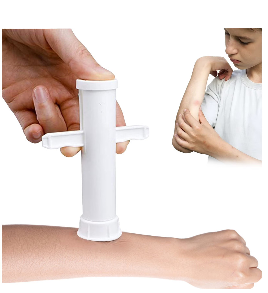 2 PK Bug Bite Relief Insect Poison Remover Suction Tool For Insect Bite Sting
